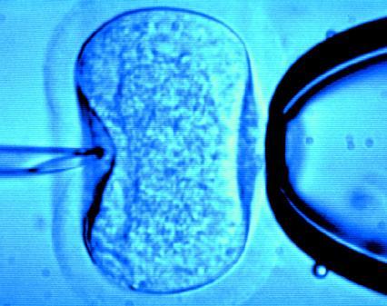 fertilizzazione in vitro tumore al seno
